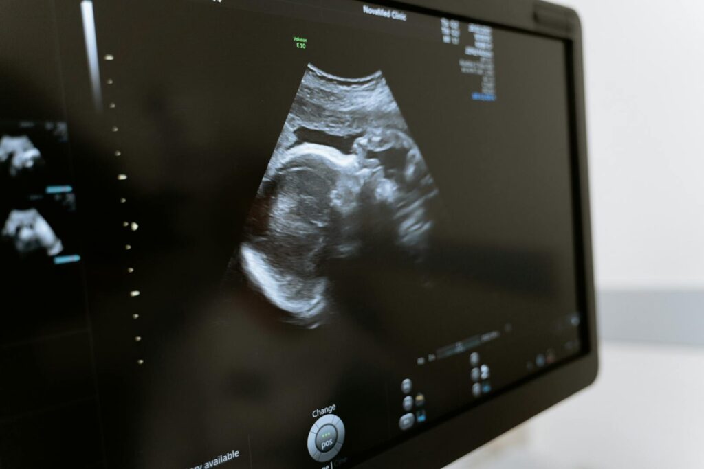 Free stock photo of 3d scanning, 3d ultrasound, analysis